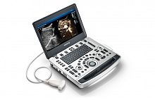 Ультразвуковая диагностическая система M9