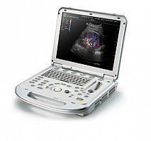 Ультразвуковая диагностическая система M7