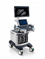 Ультразвуковая диагностическая система Resona 6