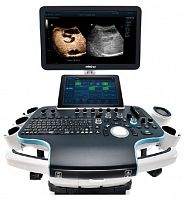 Ультразвуковая диагностическая система Resona 7